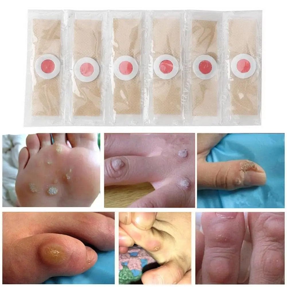 SD Soft Corn Protection Pads – Protect Toes from Friction & Pressure 👣 - dmore