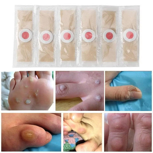 SD Soft Corn Protection Pads – Protect Toes from Friction & Pressure 👣 - dmore