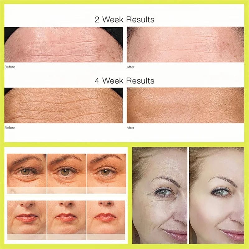 MD Korean Retinol Booster- Smooth, Firm & Ageless - dmore