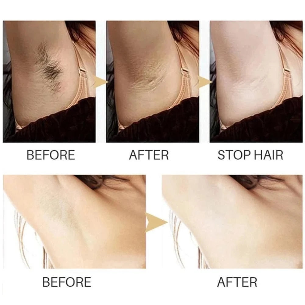 MD Hair Inhibitor Serum – Effortless Hair Reduction 💧 - dmore