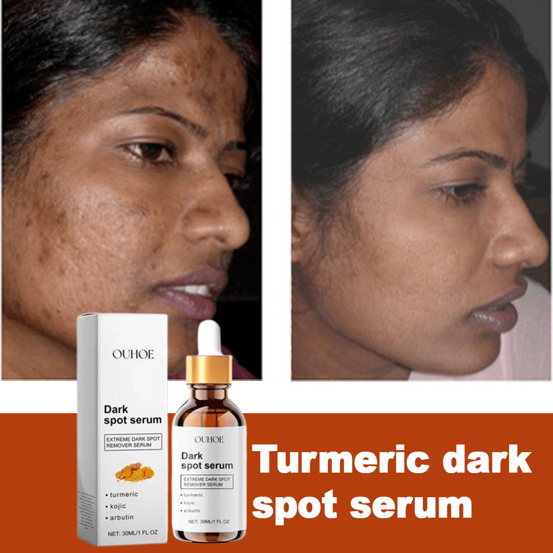 MD Turmeric Spot Corrector Serum - Fade Dark Spots in 2 Weeks 🌟💛 - dmore