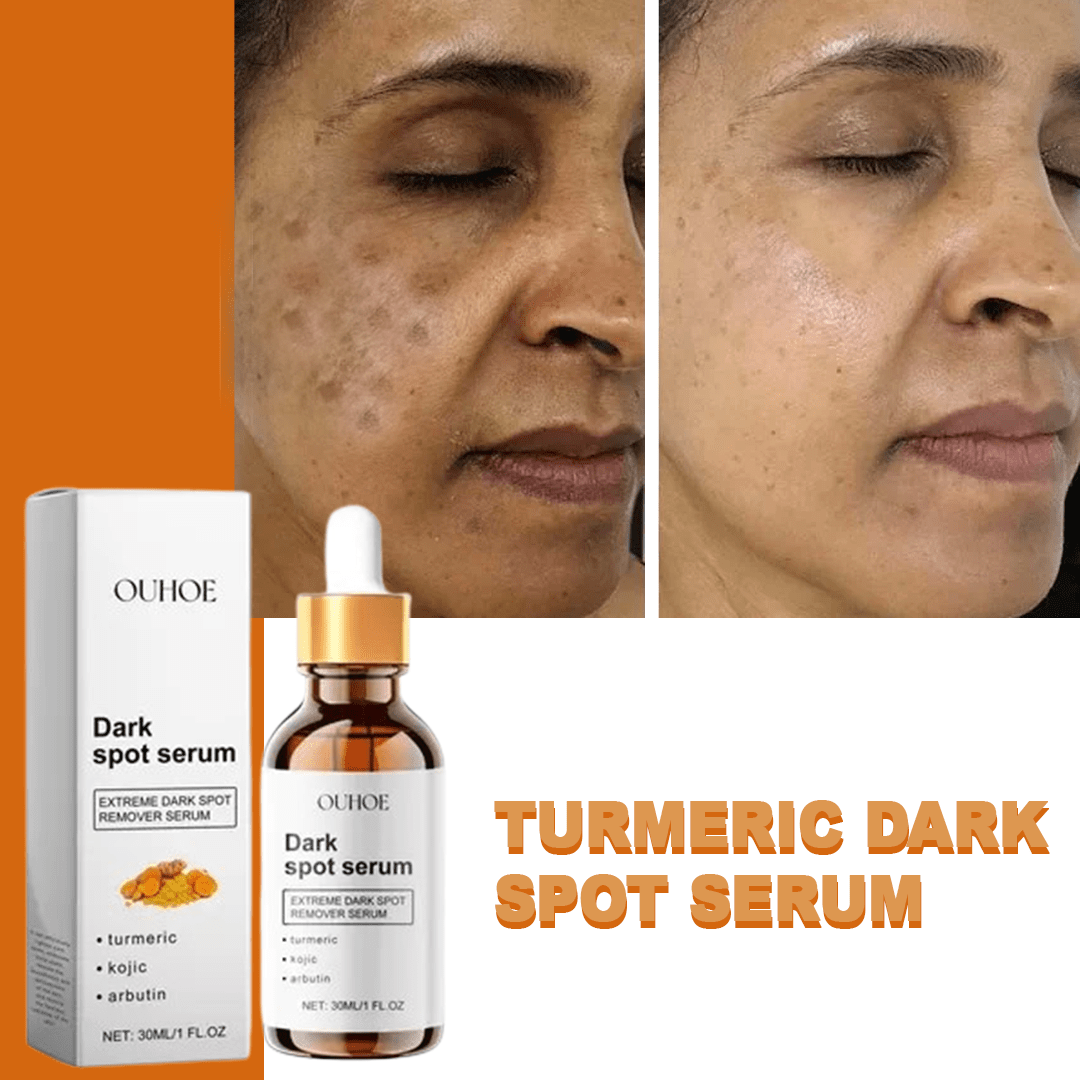 MD Turmeric Spot Corrector Serum - Fade Dark Spots in 2 Weeks 🌟💛 - dmore