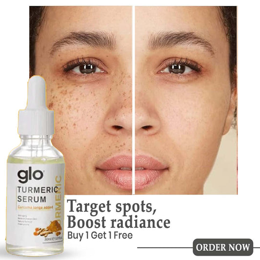MD Turmeric Spot Corrector Serum – Buy 1 Get 1 FREE 🌿🔥Now @499🔥 - dmore