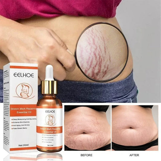 🌿 SC D-More Doctor's Approved Stretch Mark Oil – Naturally Effective! 🌿 - dmore
