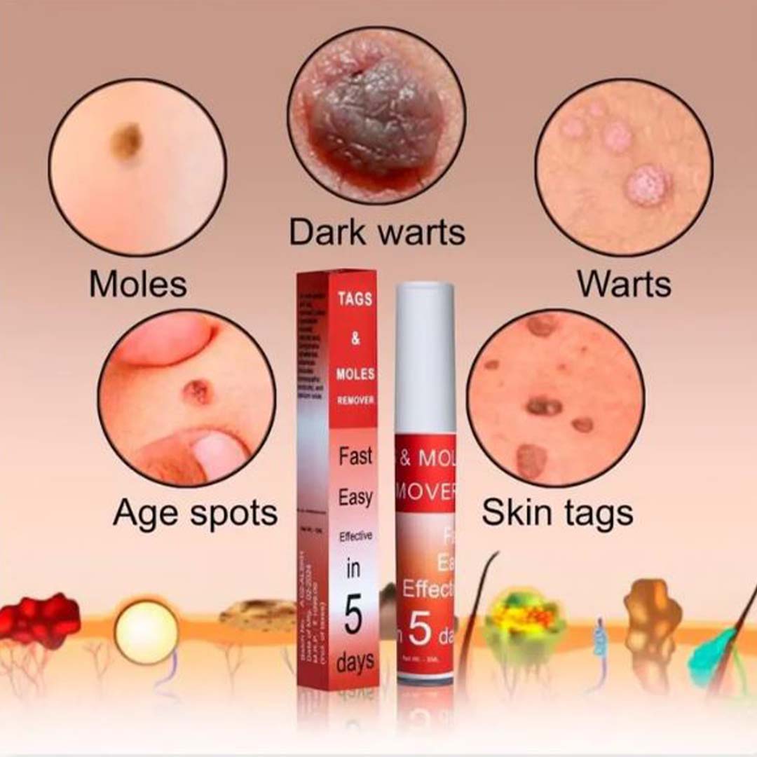 MD Mole & Tag Remover 🌿 Limited Time (Buy 1 Get 1 FREE)🔥Fast, Safe, Effective - dmore