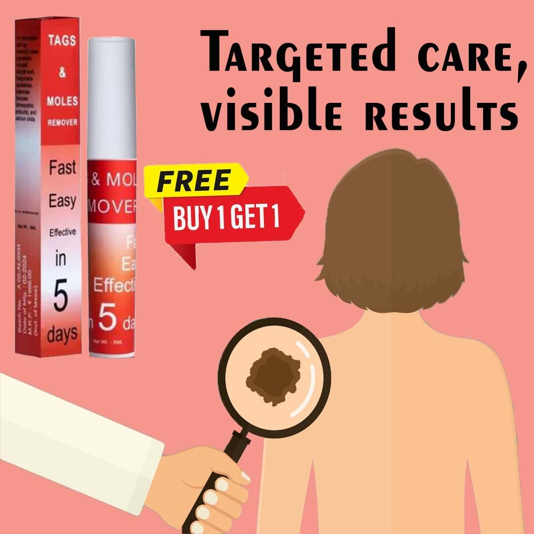 MD Mole & Tag Remover 🌿 Limited Time (Buy 1 Get 1 FREE)🔥Fast, Safe, Effective - dmore