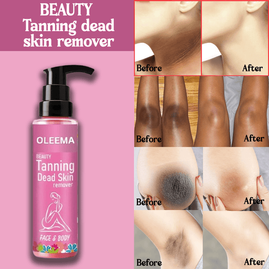 MD Oleema Beauty Tanning Dead Skin Remover-🔥Buy 1 Get 1 Free 🔥(100% Money Back) - dmore