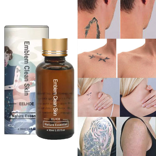 SD Quick Tattoo Removal Serum – Fade Ink from Skin, Lips & Brows Fast - dmore
