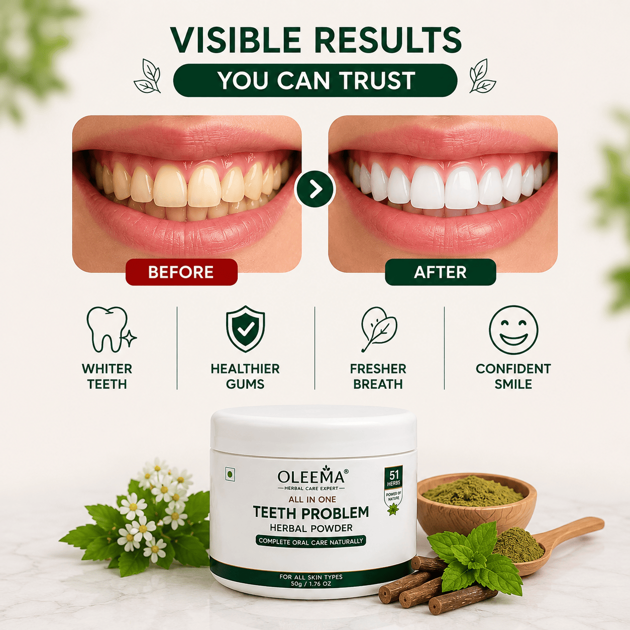 SD 51 Herbal Ingredients Teeth Powder | Complete Oral Care, Naturally