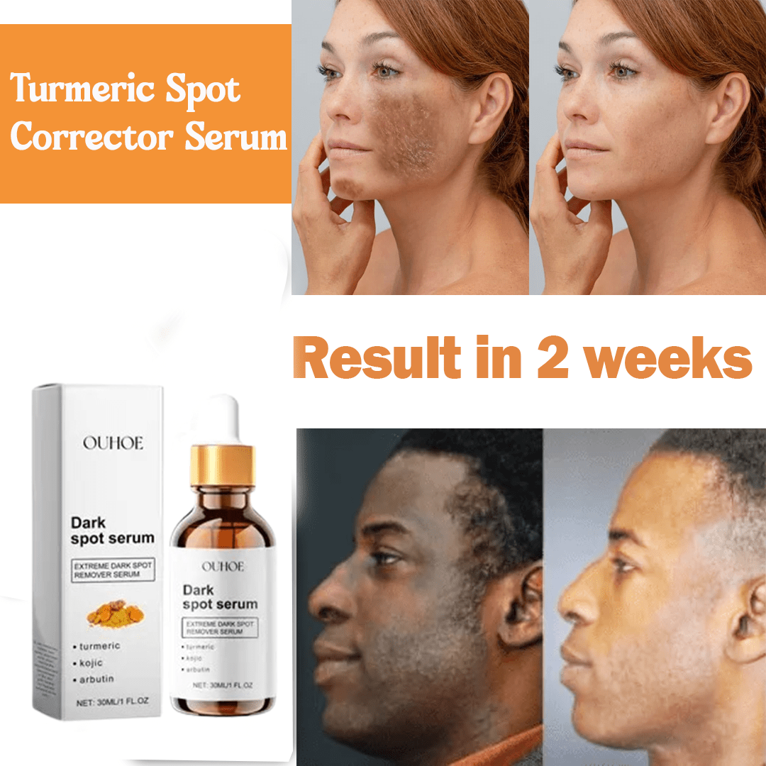 MD Turmeric Spot Corrector Serum - Fade Dark Spots in 2 Weeks 🌟💛 - dmore