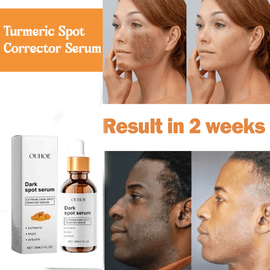 MD Turmeric Spot Corrector Serum - Fade Dark Spots in 2 Weeks 🌟💛 - dmore