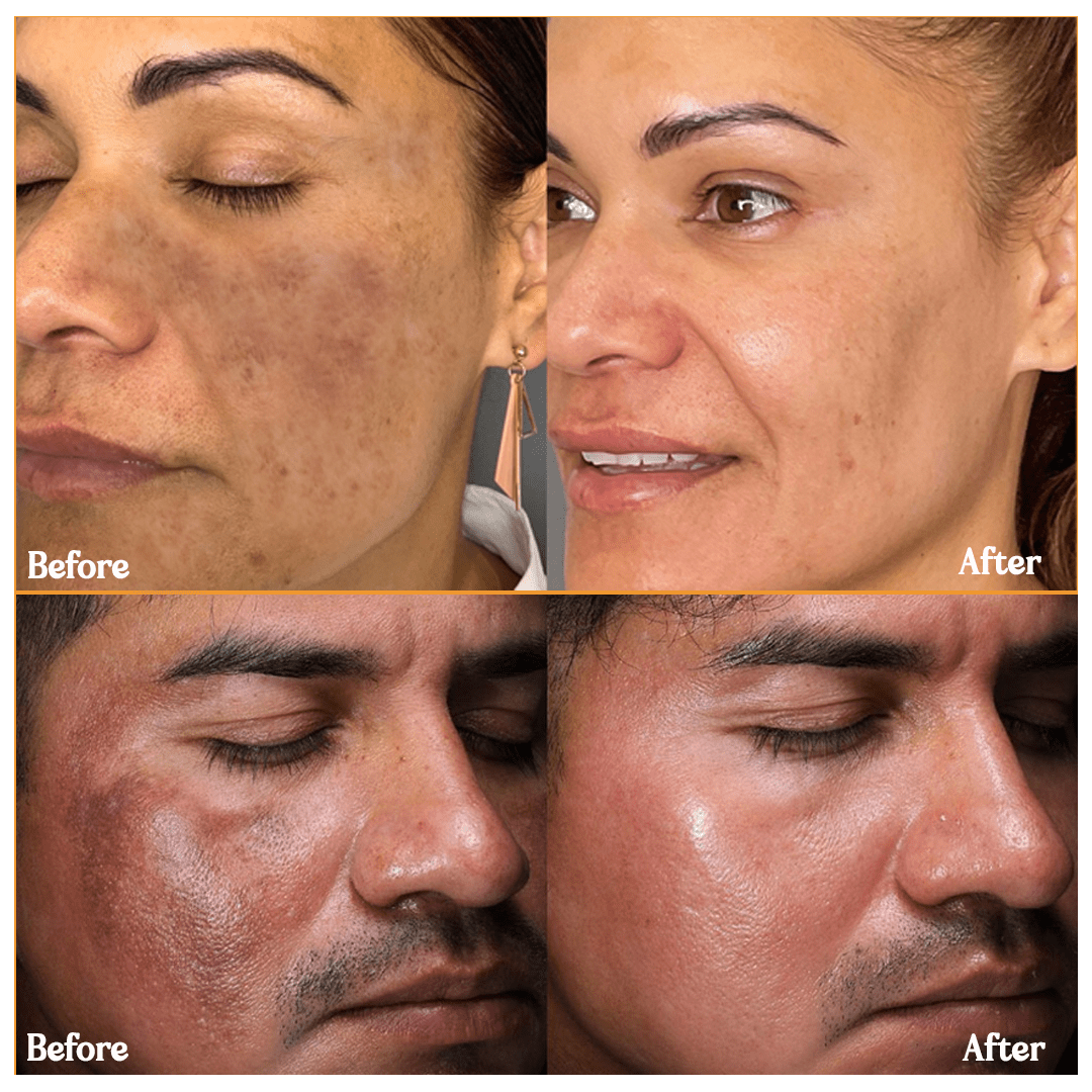 MD Turmeric Spot Corrector Serum - Fade Dark Spots in 2 Weeks 🌟💛 - dmore