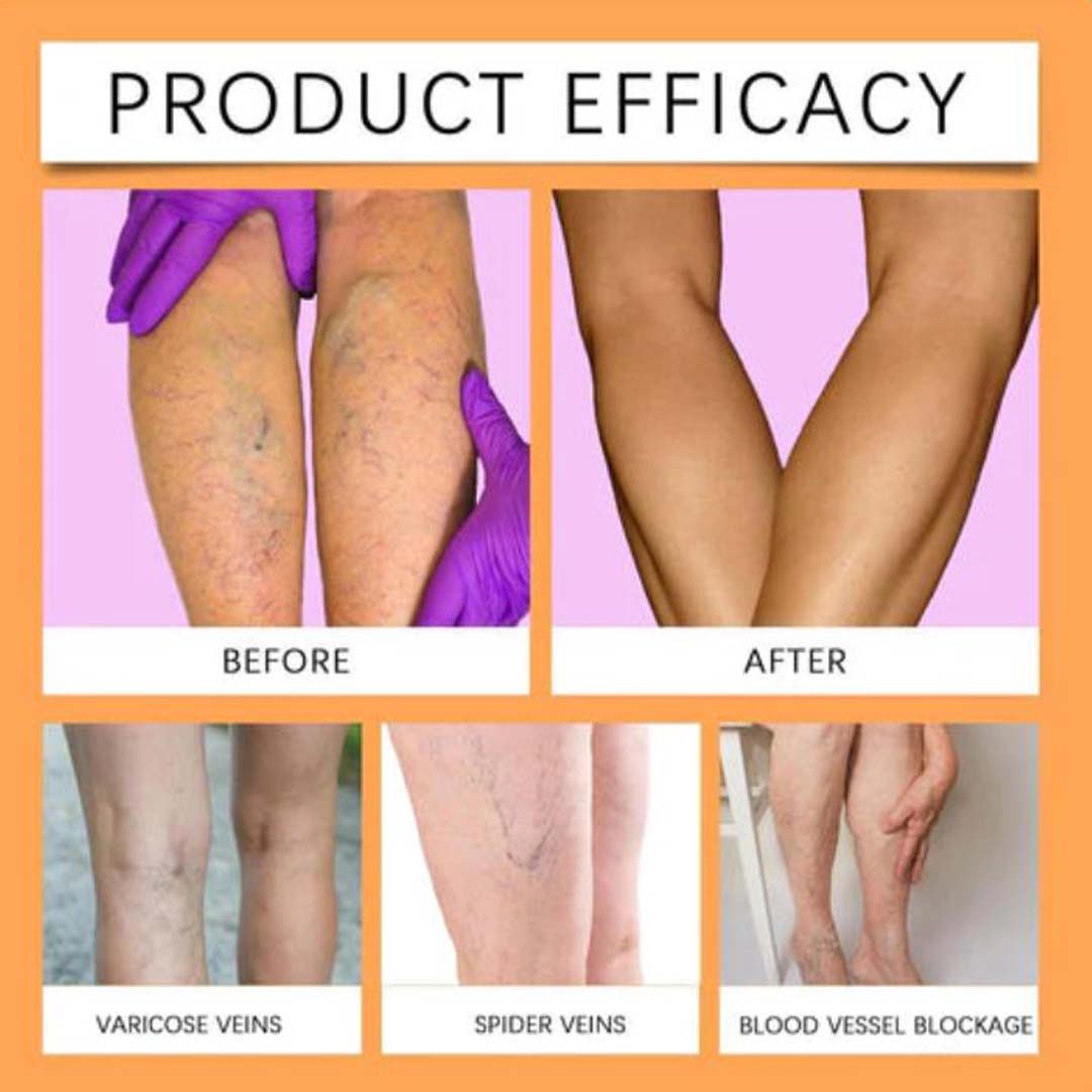 MD Leg Pain Gone, Confidence On 🔥 Buy 1 Get 1 FREE 🔥 - dmore