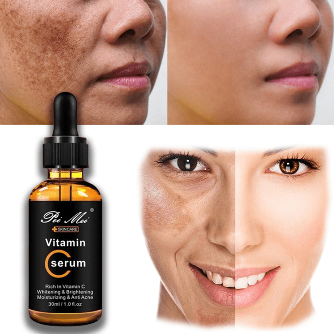 SD Ultra Glow Vitamin C Serum with Korean Anti-Aging Formula🌿 - dmore