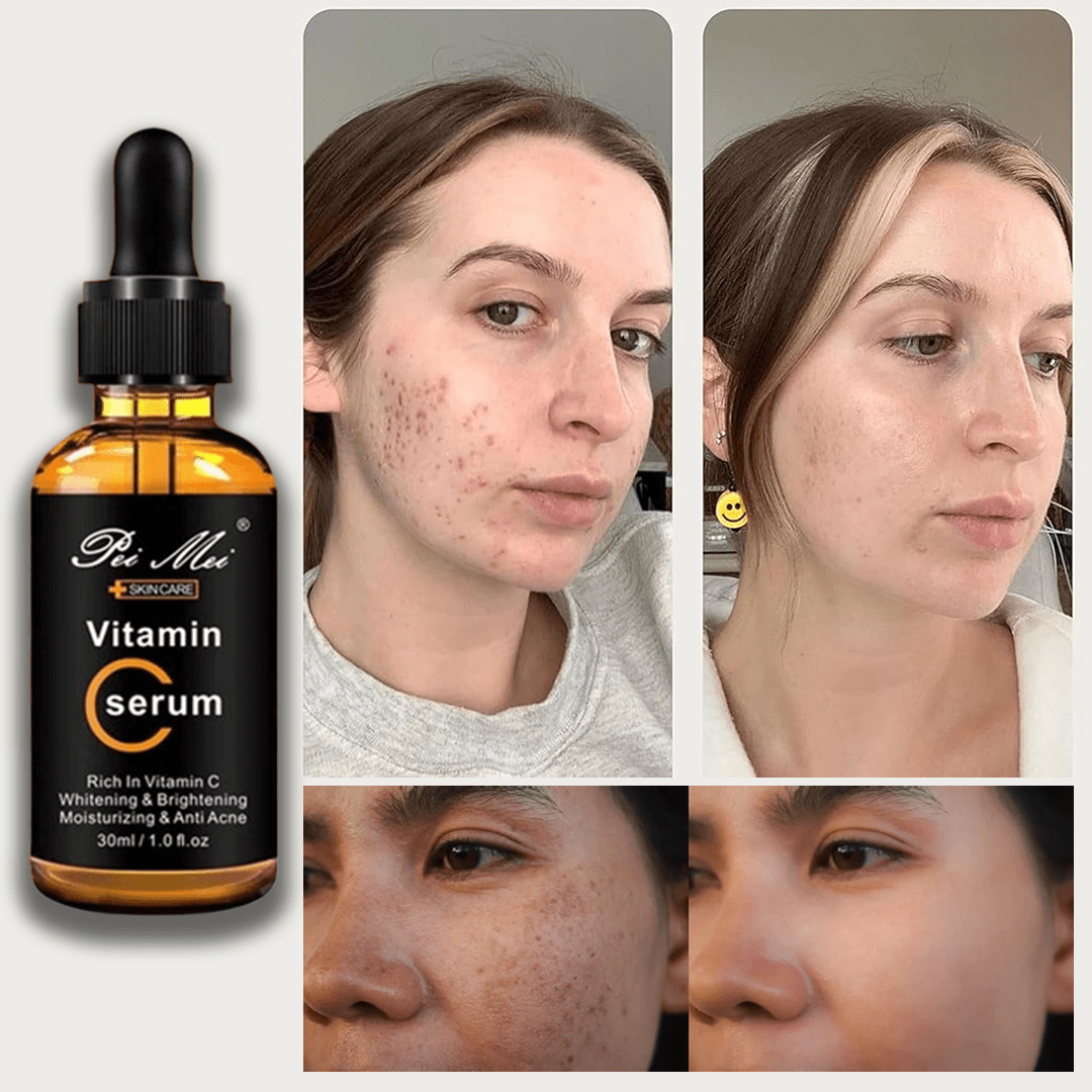 SD Ultra Glow Vitamin C Serum with Korean Anti-Aging Formula🌿 - dmore