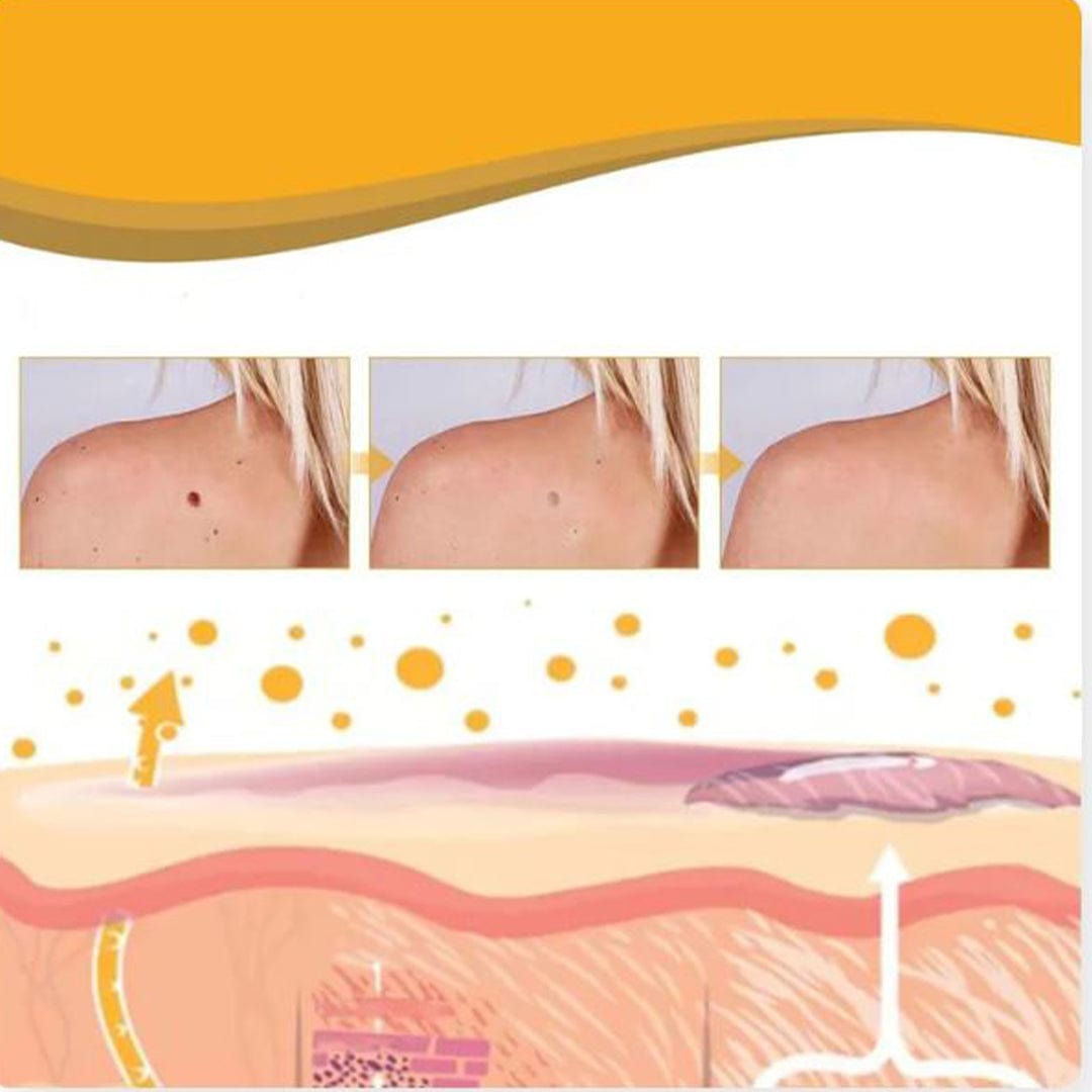 ✨ MD Flawless Skin in Weeks – Bee Venom Tag & Wart Remover  ✨ - dmore