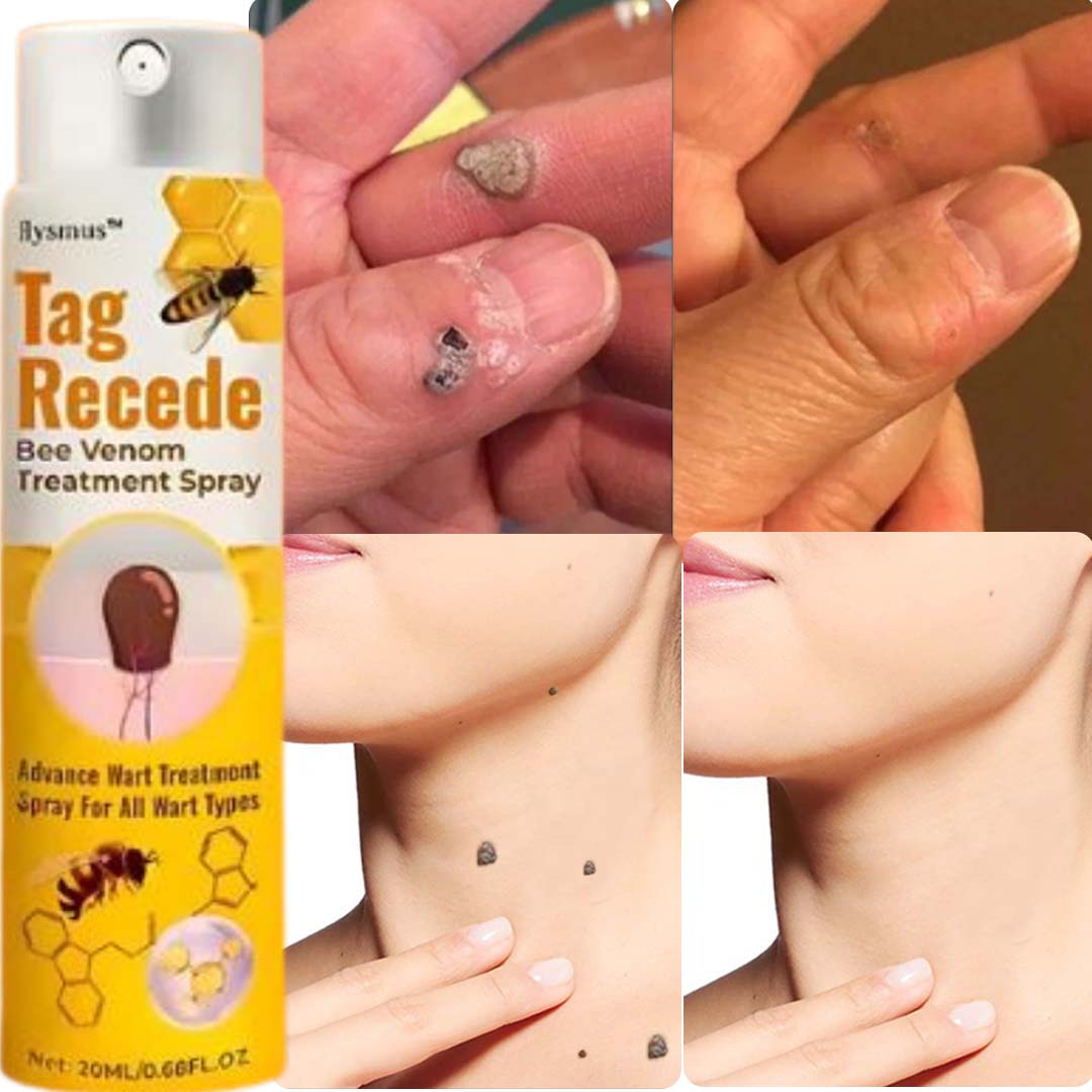 ✨ MD Flawless Skin in Weeks – Bee Venom Tag & Wart Remover  ✨ - dmore