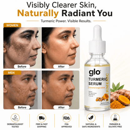 SD Turmeric Spot Corrector Serum🫚 Get result in just 7 days