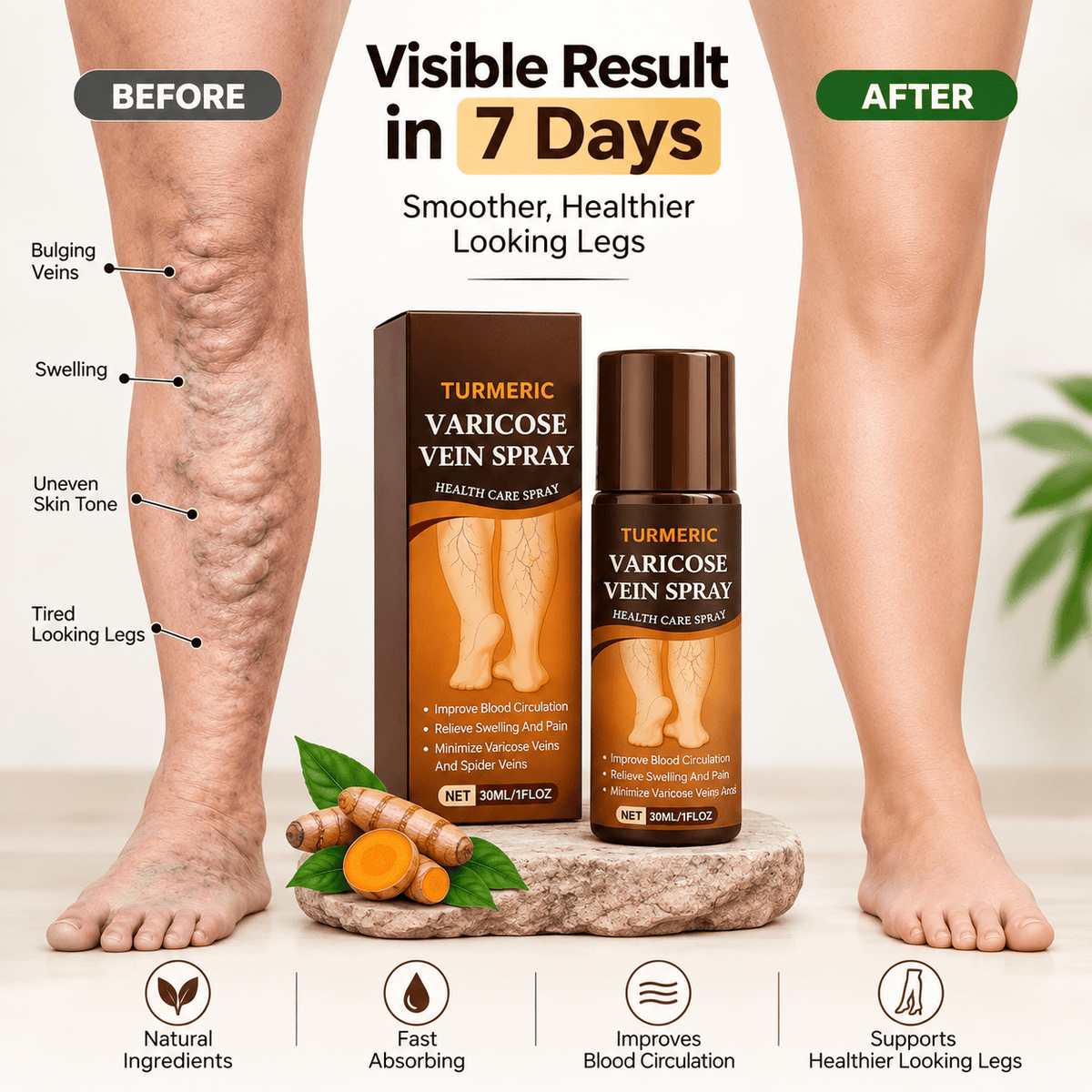 SD Herbal Turmeric Varicose Vein Spray – Feel Relief in Minutes 🌿🟡