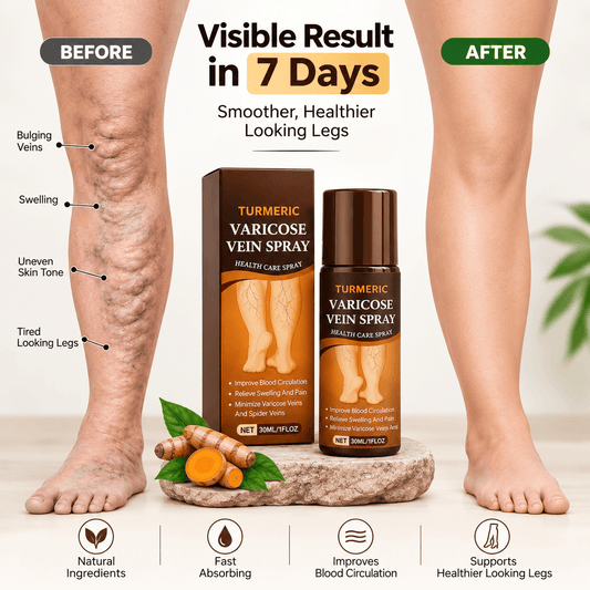 SD Herbal Turmeric Varicose Vein Spray – Feel Relief in Minutes 🌿🟡