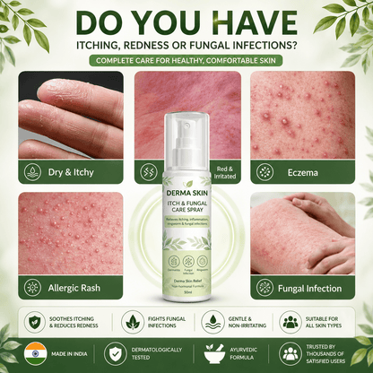 SD Derma Skin Itch & Fungal Care Spray- Dermatologist tested Itch & Fungal Care👨🏽‍⚕️