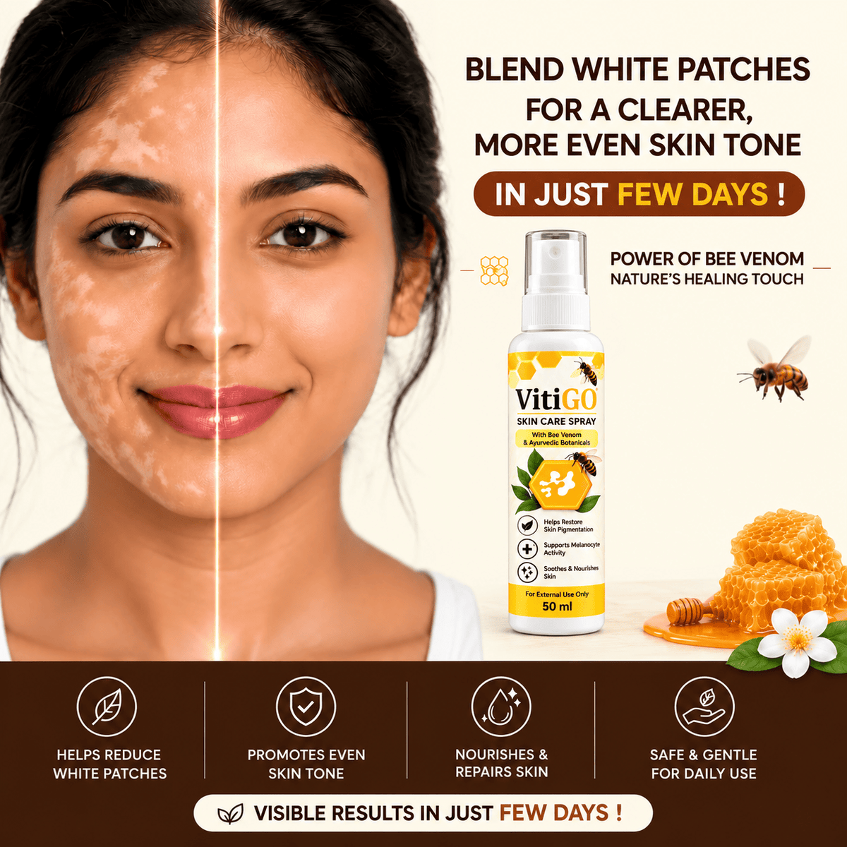 MD VitiGO Skin Care Spray with Bee Venom & Ayurvedic Botanicals | Buy 1 Get 1 Free