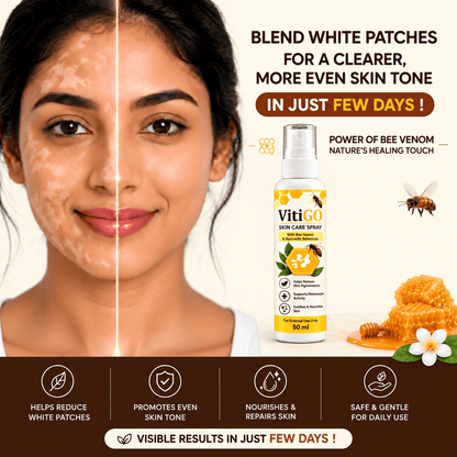 MD VitiGO Skin Care Spray with Bee Venom & Ayurvedic Botanicals | Buy 1 Get 1 Free