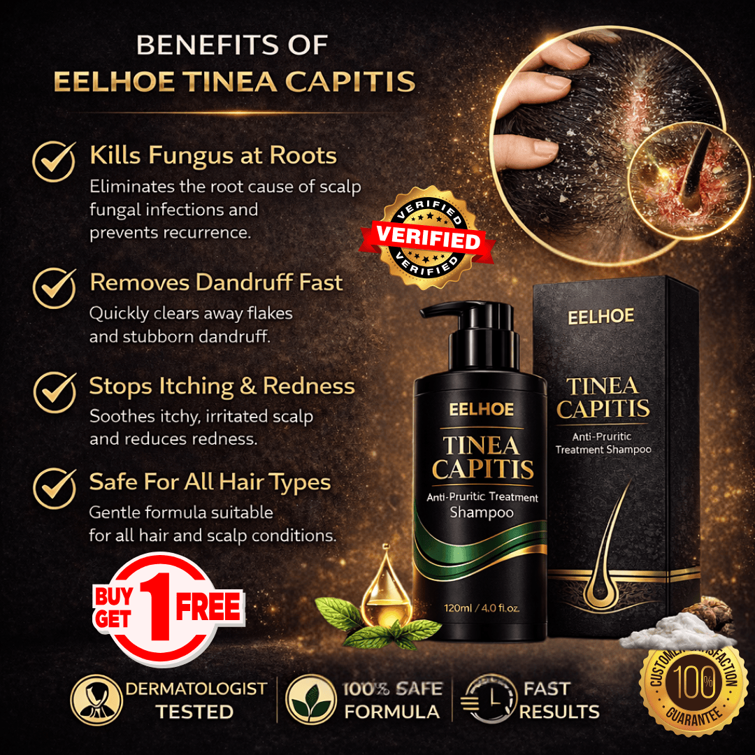 Advanced Anti-Fungal Treatment for Persistent Scalp Itching, Flakes & Root-Level Irritation. - dmore
