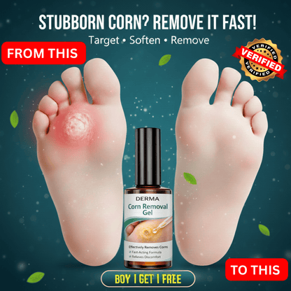 Corn Removal Serum – Fast Relief for Stubborn Foot Corns & Hard Skin - dmore