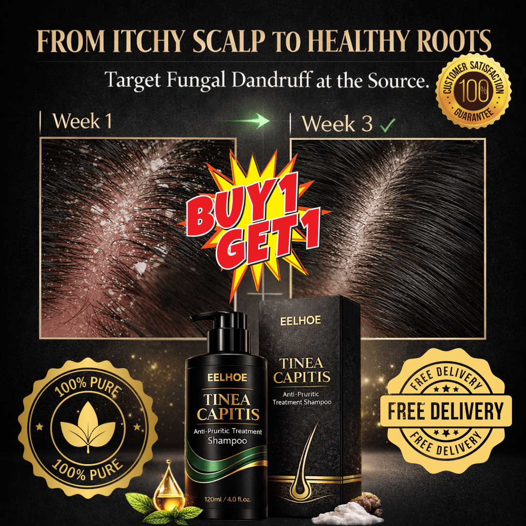 Advanced Anti-Fungal Treatment for Persistent Scalp Itching, Flakes & Root-Level Irritation. - dmore