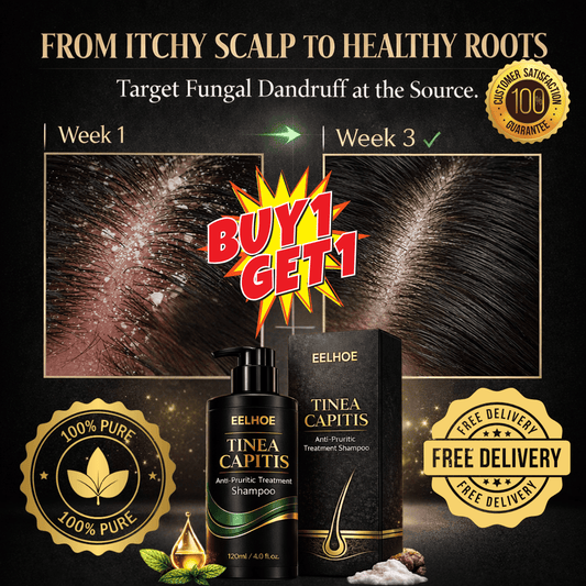 Advanced Anti-Fungal Treatment for Persistent Scalp Itching, Flakes & Root-Level Irritation. - dmore
