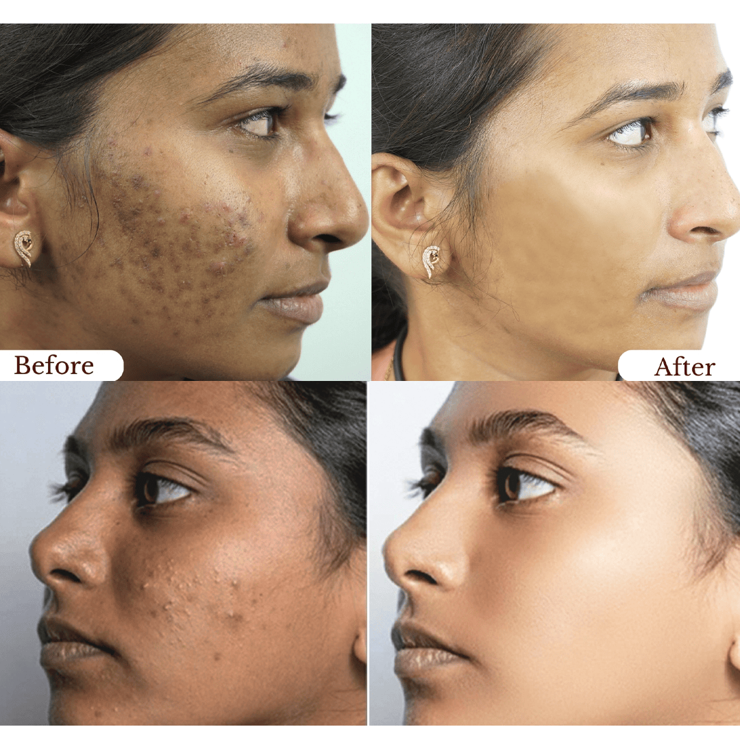 SD Orange Exfoliating Cleansing Pore Brightening Whitening Gel- Buy 1 Get 1 Free🔥🔥