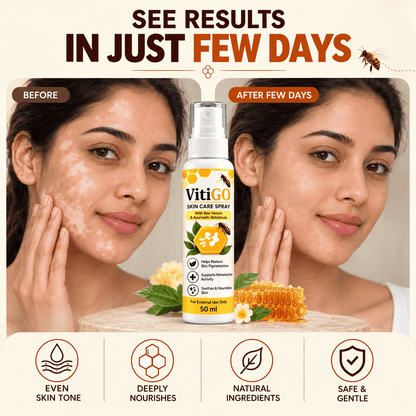 MD VitiGO Skin Care Spray with Bee Venom & Ayurvedic Botanicals | Buy 1 Get 1 Free