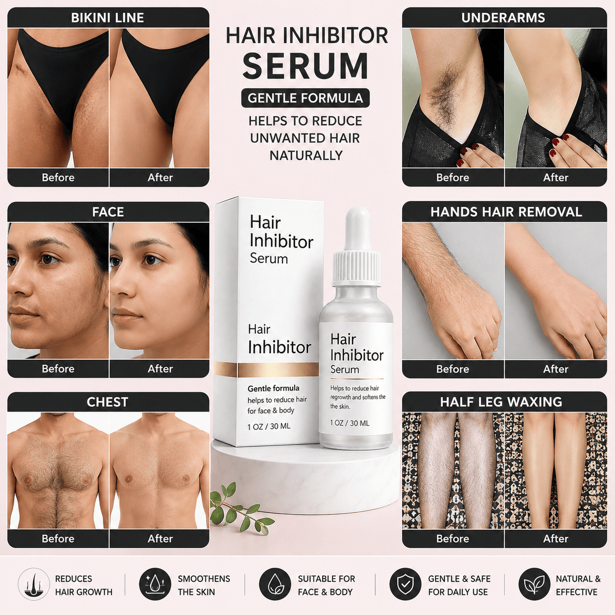 SD Hair Inhibitor Serum – Effortless Hair Reduction 💧