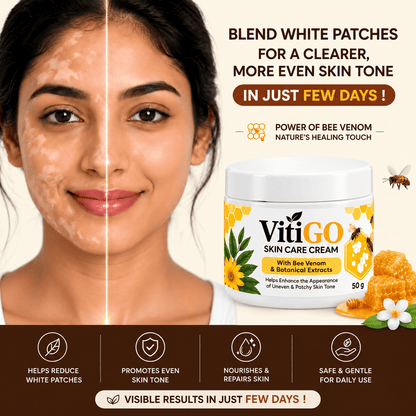 MD Advanced Vitiligo Restore Cream ✨ | Buy 1 Get 1 Free