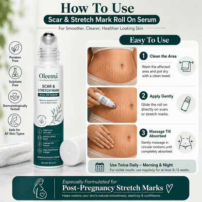 SD Scar & Stretch Mark Roll-On Serum