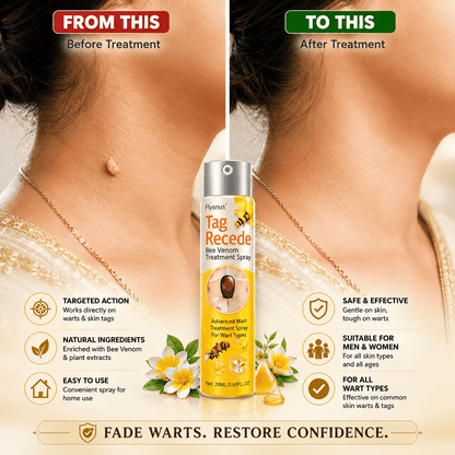 SD Bee Venom Tag & Wart Remover spray - Fast & Easy At-Home in 3 weeks