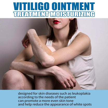 MD Herbal Vitiligo Cream- Visible Results in Just 7 Days! 🌸 PACK 2 - dmore