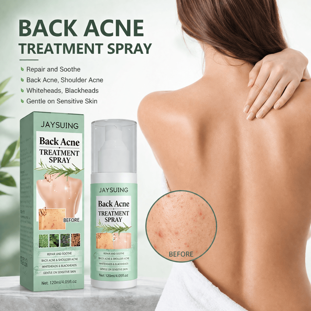 MD Back Acne Spray – Easy, Effective, Acne-Free 🌿 - dmore