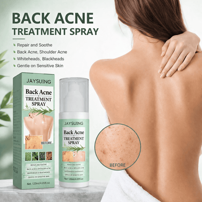 MD Back Acne Spray – Easy, Effective, Acne-Free 🌿 - dmore
