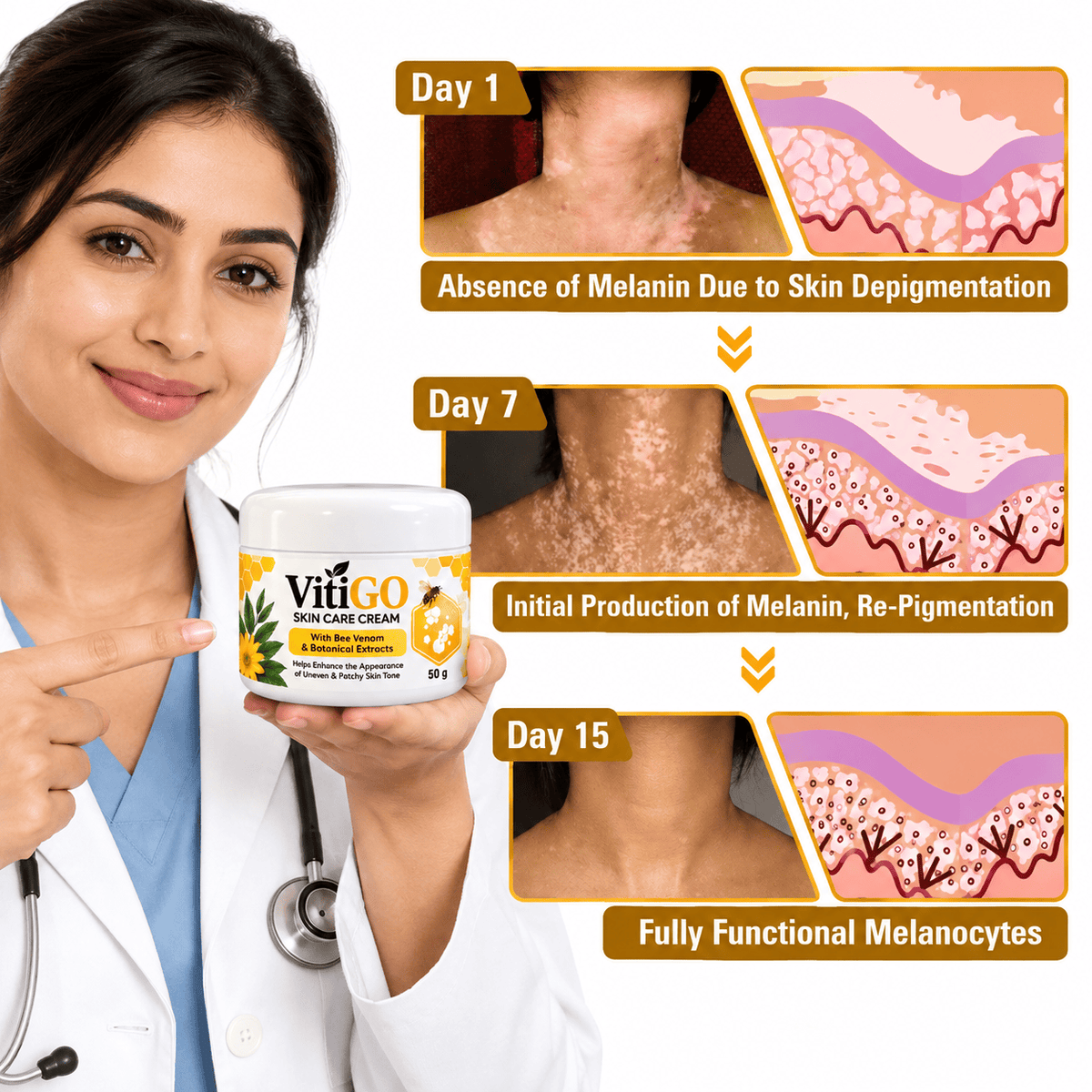MD Advanced Vitiligo Restore Cream ✨ | Buy 1 Get 1 Free