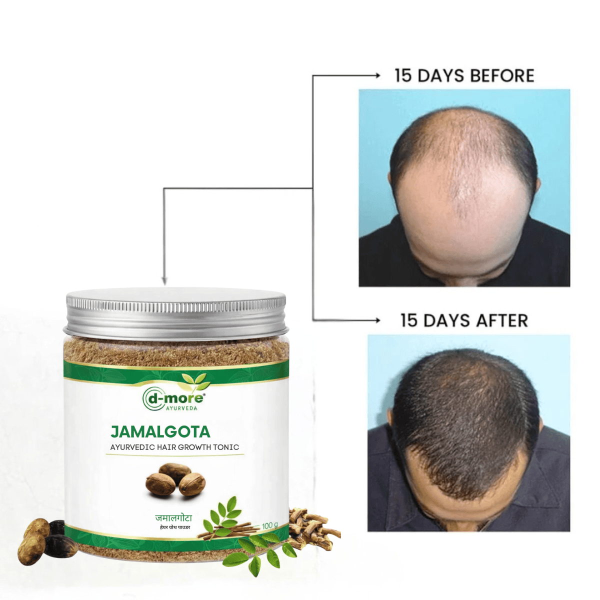 MD Jamalgota Ayurvedic Hair Growth & Care Powder 🌿 - dmore