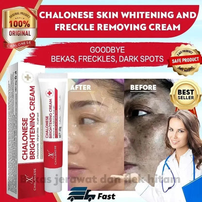 MD Chalonese Brightening Cream – Because Your Skin Deserves to Shine! 🌟 - dmore