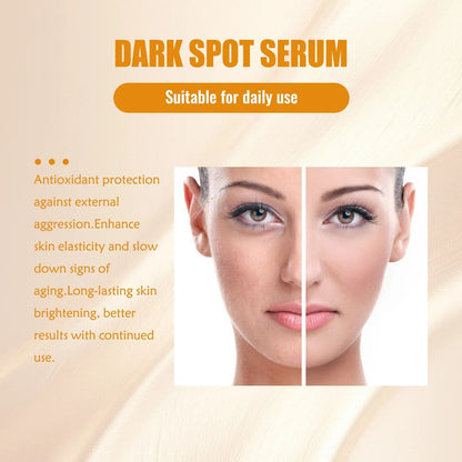 MD Turmeric Spot Corrector Serum - Fade Dark Spots in 2 Weeks 🌟💛 - dmore
