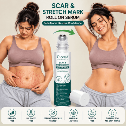 MD Oleema Scar & Stretch Mark Roll-On Serum