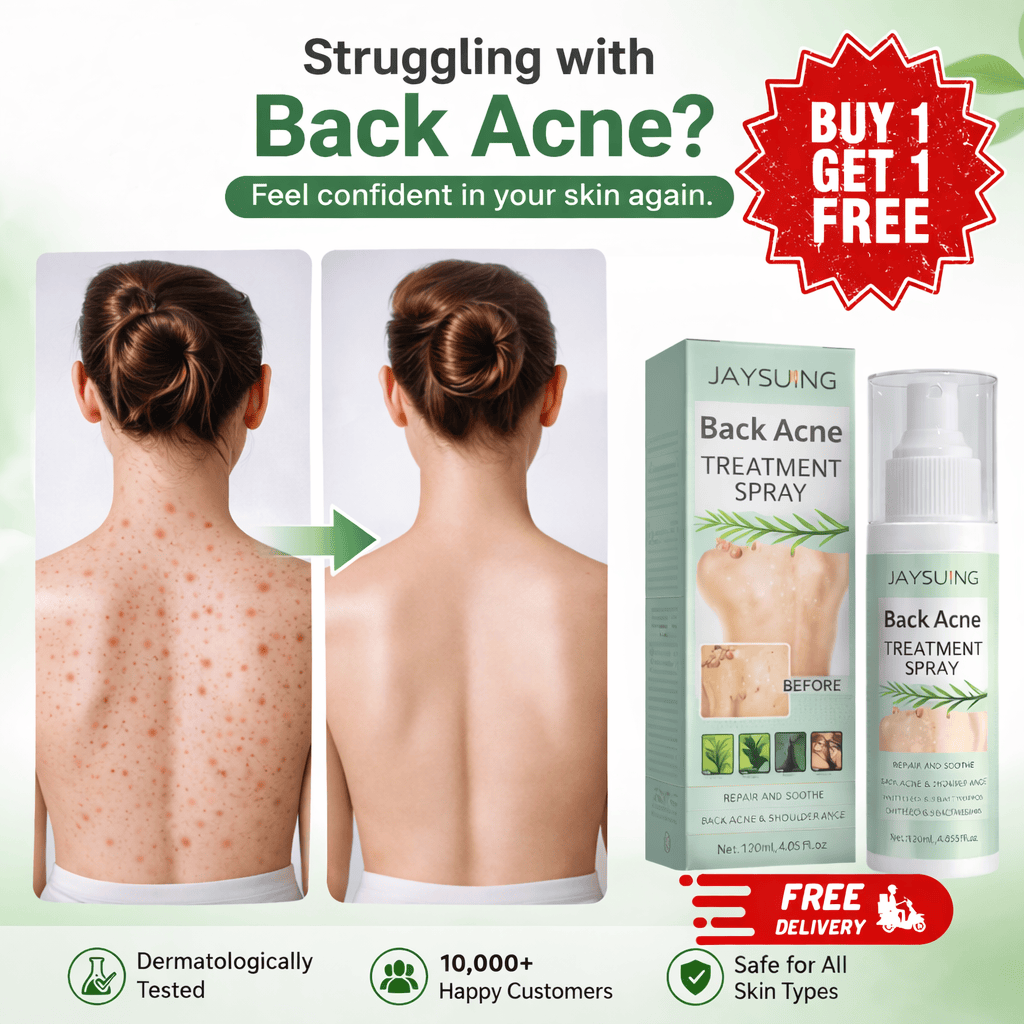 SD Back Acne Spray – Easy, Effective, Acne-Free 🌿 - dmore