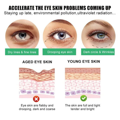 SD All-in-One Eye Cream - Say Goodbye to Puffiness & Wrinkles! 💖 Buy 1 Get 1 Free💖 - dmore