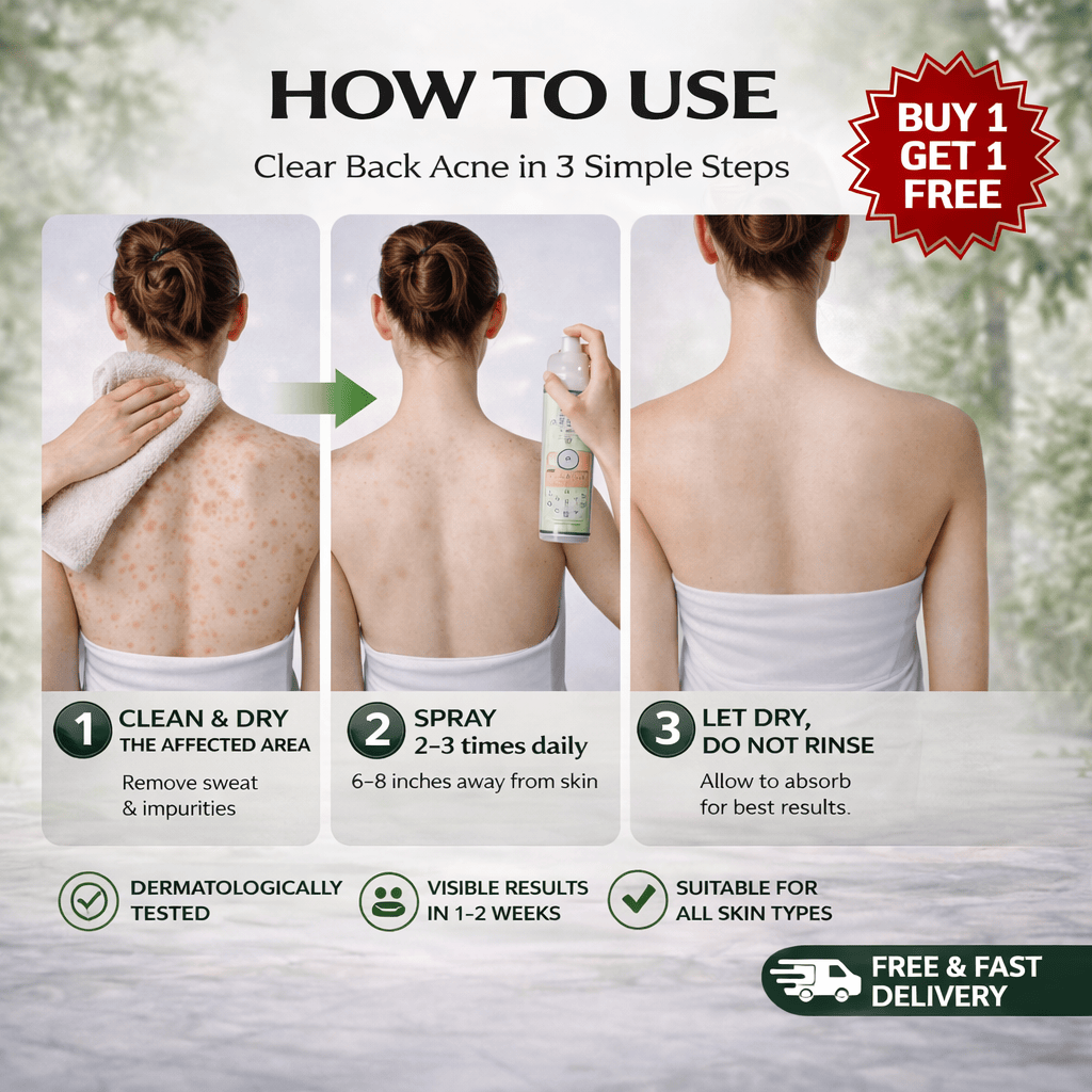 SD Back Acne Spray – Easy, Effective, Acne-Free 🌿 - dmore