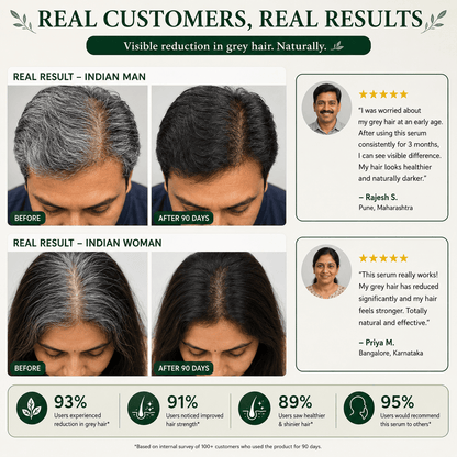 SD Oleema Anti Grey Hair Serum in just 14 days