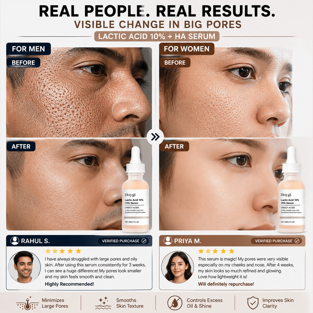 SC Pore Perfecting Serum with 10% Lactic Acid